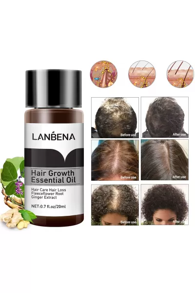 رشد مجدد موی سر افزایش گردش خون حاوی عصاره جنسینگ روغن هسته انگور زنجبیل ضخیم شدن مو لانبنا LANBENA سرم رشد مجدد موی سر و درمان ریزش مو